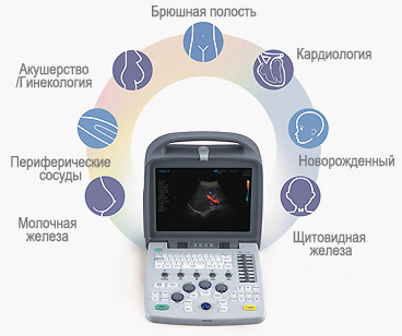 Область применения узи-сканера Appogee Область применения узи-сканера Appogee